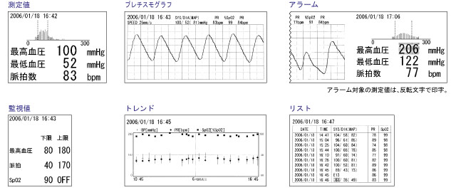 生物識(shí)別信息監(jiān)視器TM - 2571 / TM - 2572(重要盒)打印打印示例圖像 生物識(shí)別信息監(jiān)視器TM - 2571 / TM - 2572(重要盒)打印打印示例圖像